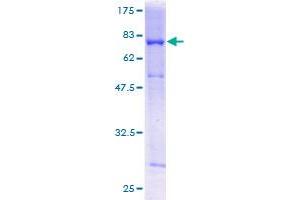 Retinoblastoma Binding Protein 4 Protein (RBBP4) (AA 1-425) (GST tag)