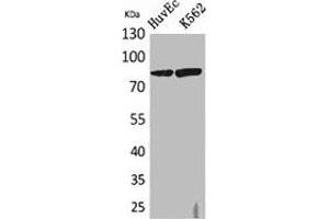 Western Blot analysis of HuvEc, K562 cells using 17β-HSD4 Polyclonal Antibody. (HSD17B4 Antikörper  (N-Term))