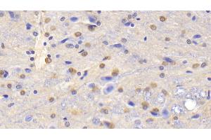 Detection of GS in Rat Cerebrum Tissue using Polyclonal Antibody to Glutamine synthetase (GS) (GLN1 Antikörper  (AA 1-373))