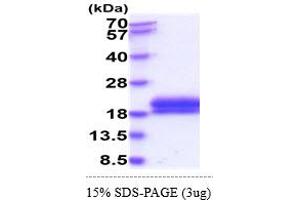 SDS-PAGE (SDS) image for Tumor Necrosis Factor Receptor Superfamily, Member 10a (TNFRSF10A) (AA 24-239) protein (His tag) (ABIN5855032) (TNFRSF10A Protein (AA 24-239) (His tag))
