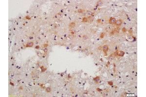 Formalin-fixed and paraffin embedded rat brain labeled with Anti-RALDH2 Polyclonal Antibody, Unconjugated  at 1:200 followed by conjugation to the secondary antibody and DAB staining (ALDH1A2 Antikörper  (AA 441-518))