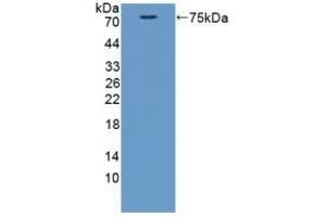 Detection of Recombinant CTTN, Mouse using Polyclonal Antibody to Cortactin (CTTN) (Cortactin Antikörper  (AA 1-509))