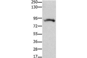Western Blot analysis of Mouse brain tissue using KCNH2 Polyclonal Antibody at dilution of 1:100 (KCNH2 Antikörper)