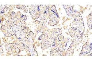 Detection of CGb in Human Placenta Tissue using Monoclonal Antibody to Chorionic Gonadotropin Beta Polypeptide (CGb) (CGB Antikörper  (AA 31-165))