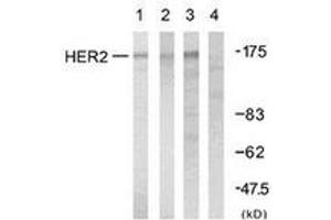 Western blot analysis of extracts from A2780 cells, using HER2 (Ab-1248) Antibody. (ErbB2/Her2 Antikörper  (AA 1206-1255))