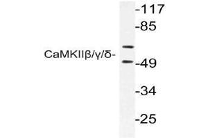 Western blot (WB) analysis of CaMKIIbeta/gamma/delta antibody in extracts from rat brain cells. (CAMK2B Antikörper)