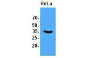 The extracts of HeLa (50 ug) were resolved by SDS-PAGE, transferred to PVDF membrane and probed with anti-human EIF2S1 (1:1000).