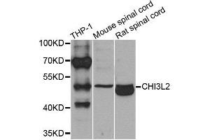 Western blot analysis of extracts of various cells, using CHI3L2 antibody.