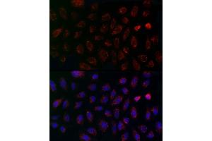 Immunofluorescence analysis of A-549 cells using MCU Rabbit pAb (ABIN7268549) at dilution of 1:200 (40x lens). (MCU Antikörper  (AA 1-351))