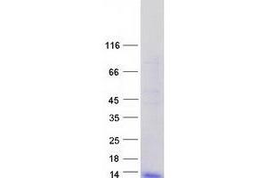 Western Blotting (WB) image for Defensin, beta 1 (DEFB1) protein (Myc-DYKDDDDK Tag) (ABIN2719352)