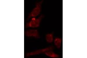 ABIN6274038 staining HepG2 by IF/ICC. (Melanoma gp100 Antikörper  (C-Term))