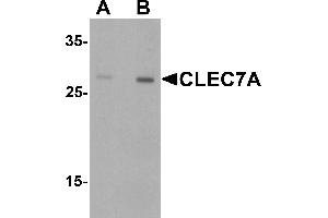 Western blot analysis of CLEC7A in rat spleen tissue lysate with CLEC7A antibody at (A) 1 and (B) 2 ugg/.