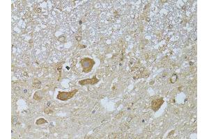 Immunohistochemistry of paraffin-embedded rat spinal cord using HDAC8 antibody (ABIN5973443) at dilution of 1/100 (40x lens). (HDAC8 Antikörper)