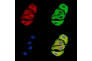 ABIN7096403 and ABIN7100467 staining Hela cells by IF/ICC. (TIMMDC1 Antikörper)