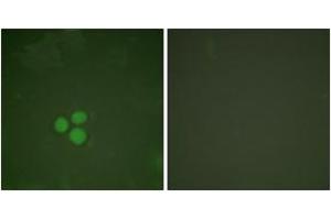 Immunofluorescence analysis of HeLa cells, using DP-1 Antibody. (TGM4 Antikörper  (AA 361-410))