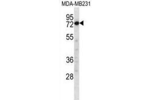 Western Blotting (WB) image for anti-Calpain 8 (CAPN8) antibody (ABIN2997182) (Calpain 8 Antikörper)