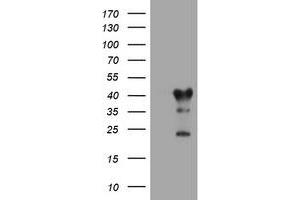 Image no. 1 for anti-Transmembrane Protein 173 (TMEM173) antibody (ABIN1501430) (STING/TMEM173 Antikörper)