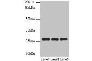 Western blot All lanes: PEX11B antibody at 10 μg/mL Lane 1: 293T whole cell lysate Lane 2: Hela whole cell lysate Lane 3: K562 whole cell lysate Secondary Goat polyclonal to rabbit IgG at 1/10000 dilution Predicted band size: 29, 27 kDa Observed band size: 27 kDa (PEX11B Antikörper  (AA 9-228))