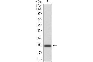 Western Blotting (WB) image for anti-NADPH Oxidase 4 (NOX4) (AA 210-310) antibody (ABIN5872374) (NADPH Oxidase 4 Antikörper  (AA 210-310))