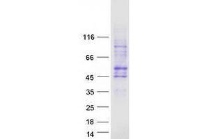 Validation with Western Blot (SLC35G2 Protein (Transcript Variant 1) (Myc-DYKDDDDK Tag))