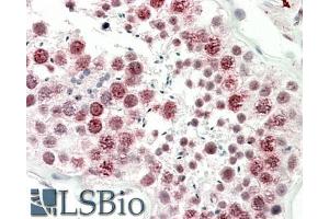 ABIN5539855 (5µg/ml) staining of paraffin embedded Human Testis. (DNAJC5G Antikörper  (Internal Region))
