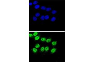 Confocal immunofluorescent analysis of BAG1 Antibody (C-term) (ABIN389451 and ABIN2839520) with Hela cell followed by Alexa Fluor® 488-conjugated goat anti-rabbit lgG (green). (BAG1 Antikörper  (C-Term))