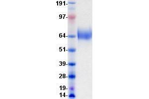Western Blotting (WB) image for Neurotrophic Tyrosine Kinase, Receptor, Type 2 (NTRK2) protein (DYKDDDDK-His Tag) (ABIN2734333)