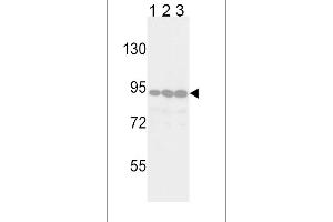 Western blot analysis of TYRO10 Antibody in Jurkat(lane 1), 293(lane 2) and Hela(lane 3) cell line lysates (35ug/lane) (DDR2 Antikörper)