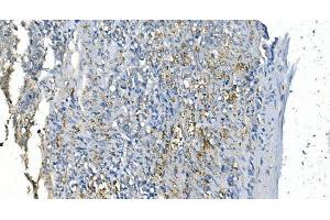IHC analysis of Carbonic Anhydrase I/CA1 using anti-Carbonic Anhydrase I/CA1 antibody (ABIN7602620).
