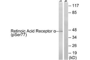 Western blot analysis of extracts from Jurkat cells treated with PMA (125 ng/mL, 30 mins), using Retinoic Acid Receptor α(Phospho-Ser77) antibody.
