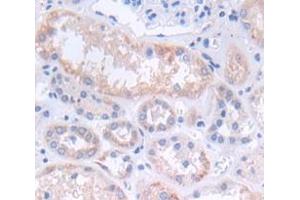 IHC-P analysis of Kidney tissue, with DAB staining. (CXCL12 Antikörper  (AA 23-89))