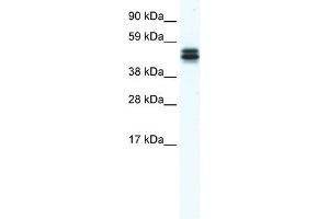 Western Blot showing E130307M08RIK antibody used at a concentration of 1-2 ug/ml to detect its target protein.