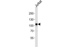 Western Blotting (WB) image for anti-C-Mer Proto-Oncogene Tyrosine Kinase (MERTK) antibody (ABIN3003537) (MERTK Antikörper)