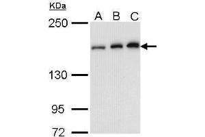 Western Blotting (WB) image for anti-rho-Associated, Coiled-Coil Containing Protein Kinase 1 (ROCK1) (N-Term) antibody (ABIN2856887)