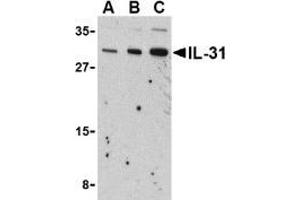 Western blot analysis of IL-31 in RAW264. (IL-31 Antikörper  (N-Term))