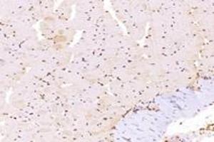 Immunohistochemistry (Paraffin-embedded Sections) (IHC (p)) image for anti-T-Box 10 (TBX10) antibody (ABIN7075814)