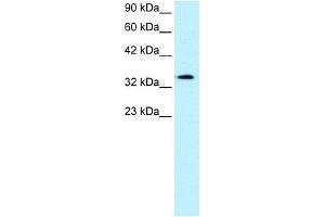 WB Suggested Anti-PAWR Antibody Titration:  0.