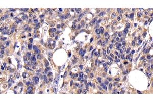 Immunohistochemistry (IHC) image for anti-Caspase 10, Apoptosis-Related Cysteine Peptidase (CASP10) (AA 223-459) antibody (ABIN7443104)