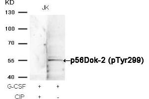 Western blot analysis of extracts from JK cells, treated with G-CSF or calf intestinal phosphatase (CIP), using p56Dok-2 (Phospho-Tyr299) Antibody. (DOK2 Antikörper  (pTyr299))
