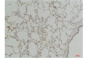 Immunohistochemistry (IHC) image for anti-Endothelin Receptor Type B (EDNRB) antibody (ABIN3181670)