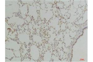 Immunohistochemistry (IHC) analysis of paraffin-embedded Rat LungTissue using Endothelin B ReceptorRabbit Polyclonal Antibody diluted at 1:200. (EDNRB Antikörper)