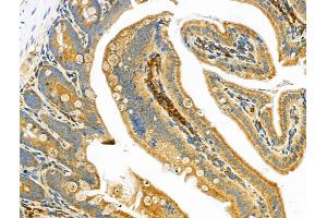 ABIN6262622 and ABIN6268657 at 1/100 staining Mouse colorectal tissue by IHC-P. (IL12B Antikörper  (C-Term))