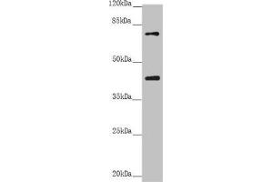 Western blot All lanes: RACGAP1 antibody at 2. (RACGAP1 Antikörper  (AA 353-632))