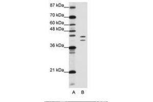 Image no. 2 for anti-Heterogeneous Nuclear Ribonucleoprotein D (HNRNPD) (AA 61-110) antibody (ABIN203267) (HNRNPD/AUF1 Antikörper  (AA 61-110))