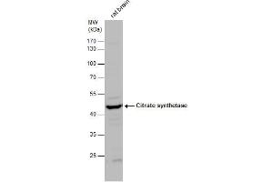 WB Image Citrate synthetase antibody detects Citrate synthetase protein by western blot analysis. (CS Antikörper)