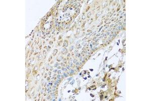 Immunohistochemistry (Paraffin-embedded Sections) (IHC (p)) image for anti-NADH Dehydrogenase (Ubiquinone) 1 alpha Subcomplex, 2, 8kDa (NDUFA2) (AA 1-95) antibody (ABIN6144461)