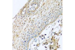 Immunohistochemistry of paraffin-embedded human esophagus using NDUFA2 antibody. (NDUFA2 Antikörper  (AA 1-95))