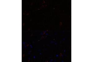 Immunofluorescence analysis of rat brain using KIF17 antibody (ABIN7268123) at dilution of 1:100. (KIF17 Antikörper  (AA 360-660))