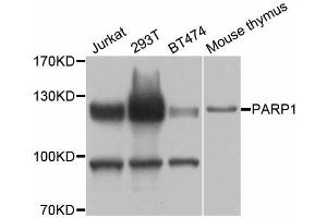 Western blot analysis of extracts of various cell lines, using PARP1 antibody (ABIN5998456) at 1/1000 dilution. (PARP1 Antikörper)