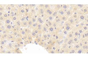 Detection of IGF1 in Mouse Liver Tissue using Polyclonal Antibody to Insulin Like Growth Factor 1 (IGF1) (IGF1 Antikörper  (AA 49-153))